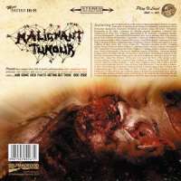 Malignant Tumour (Cze) - And Some Sick Parts Rotting Out There 1992-2002 - 2CD