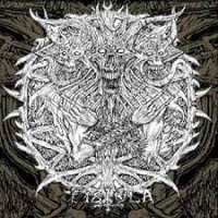 Fistula (USA) - Burdened by Your Existence - CD