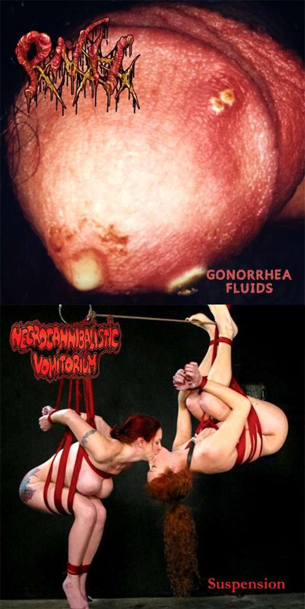  Pankreatite Necro Hemorragica (Bra) / Necrocannibalistic Vomitorium (Ukr) - Gonorrhea Fluids / Suspension - CD